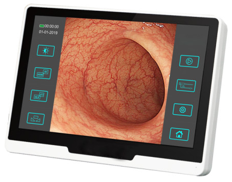Diámetro veterinario 2.8m m del equipamiento médico del endoscopio flexible