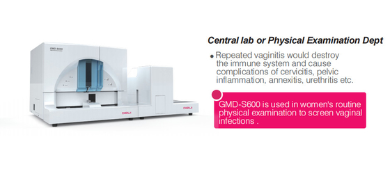 Tiras sistemáticas Vaginal Infections Analyzer de los dispositivos de ginecología ISO13485